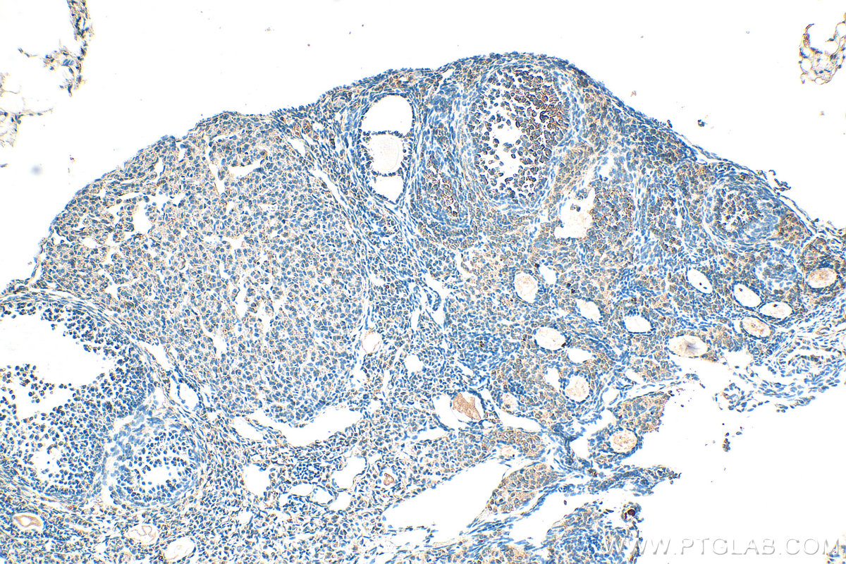 IHC staining of mouse ovary using 16649-1-AP