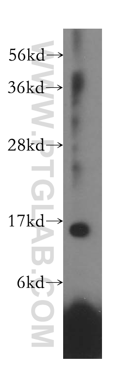 WB analysis of HeLa using 16649-1-AP