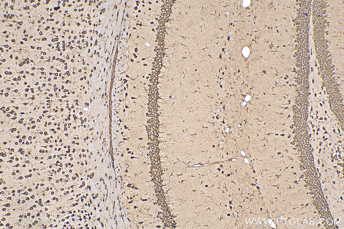 IHC staining of mouse brain using 15799-1-AP
