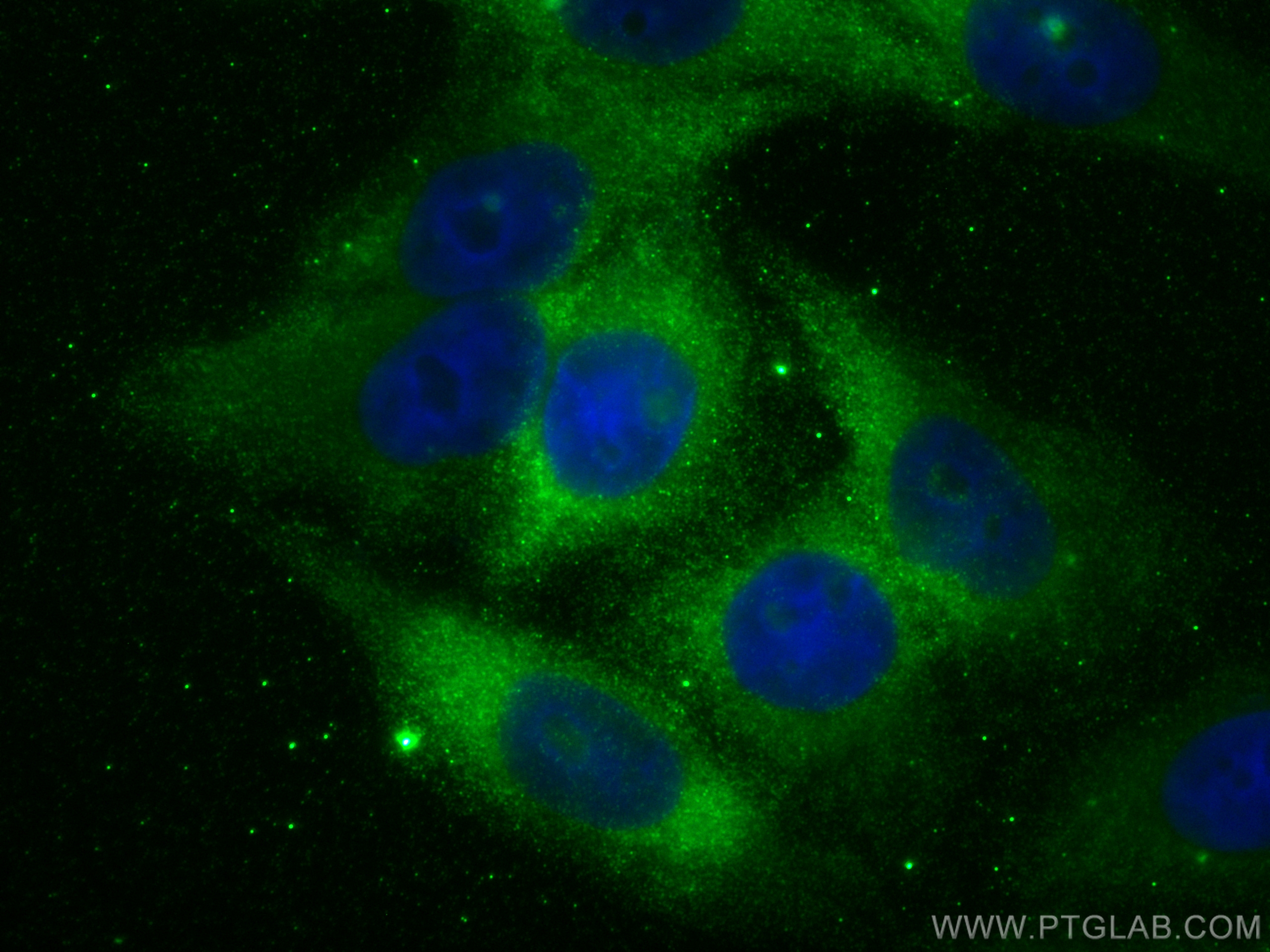 IF Staining of HepG2 using 66130-1-Ig