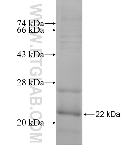 RPL32 fusion protein Ag10479 SDS-PAGE RPL32 fusion protein Ag10479 SDS-PAGE