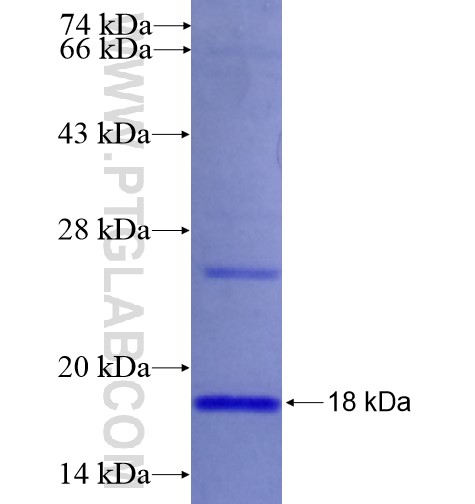 RPL36 fusion protein Ag14628 SDS-PAGE RPL36 fusion protein Ag14628 SDS-PAGE