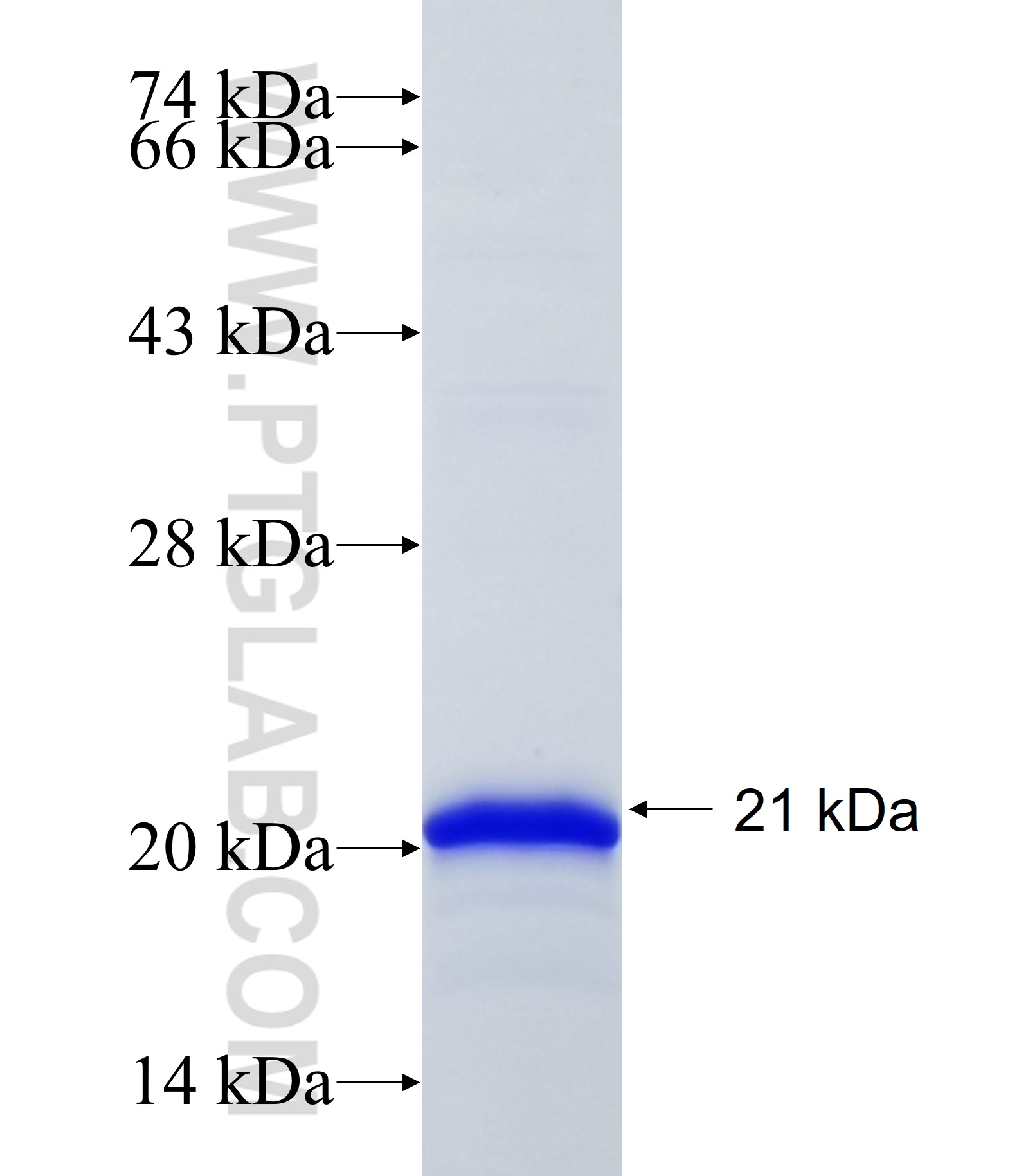 RPL37 fusion protein Ag34979 SDS-PAGE RPL37 fusion protein Ag34979 SDS-PAGE