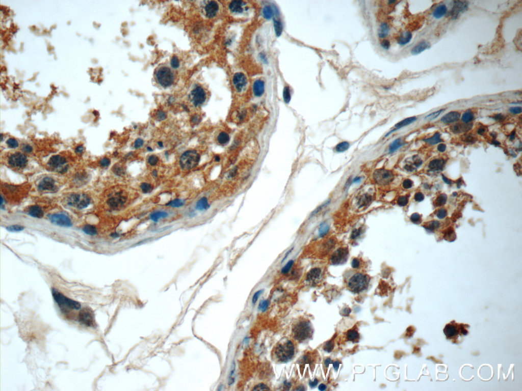 IHC staining of human testis using 24940-1-AP (same clone as 24940-1-PBS)