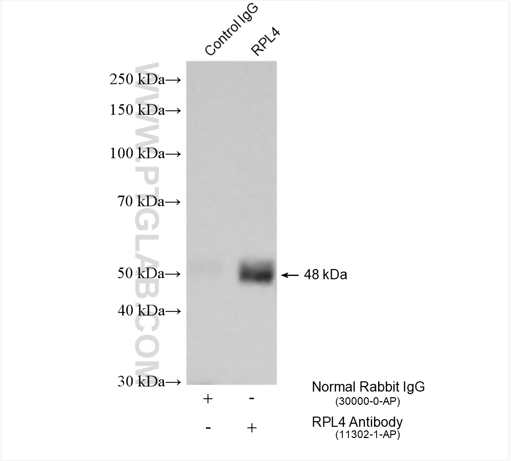 IP experiment of HeLa using 11302-1-AP