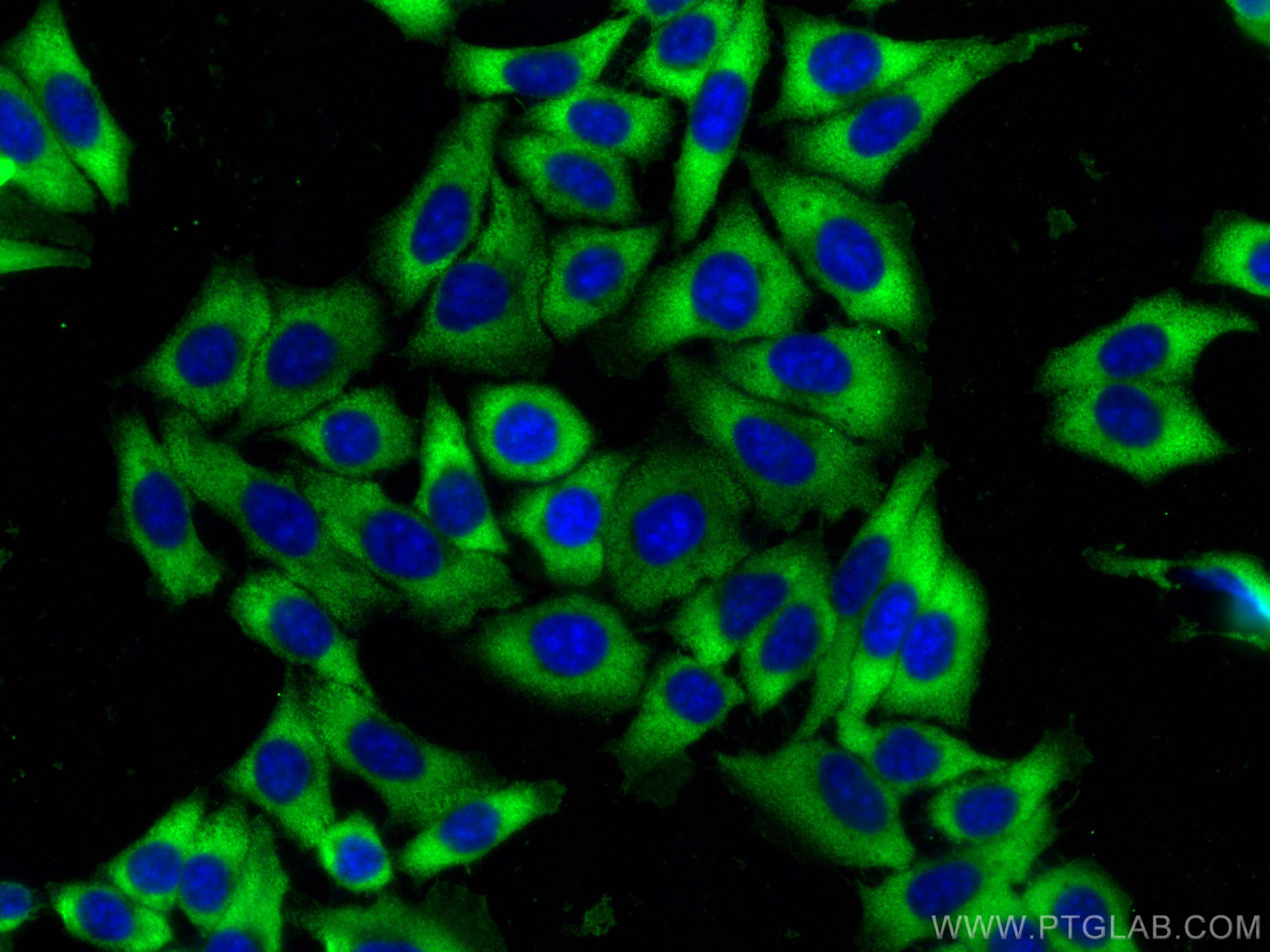 IF Staining of HepG2 using 67028-1-Ig (same clone as 67028-1-PBS)