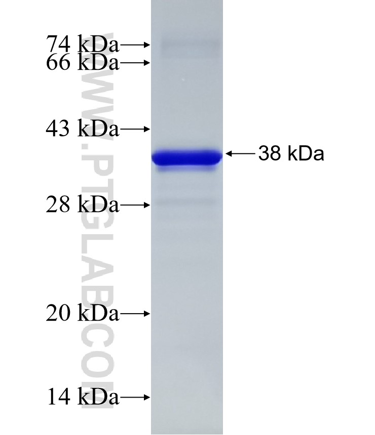 RPL4 fusion protein Ag32271 SDS-PAGE RPL4 fusion protein Ag32271 SDS-PAGE