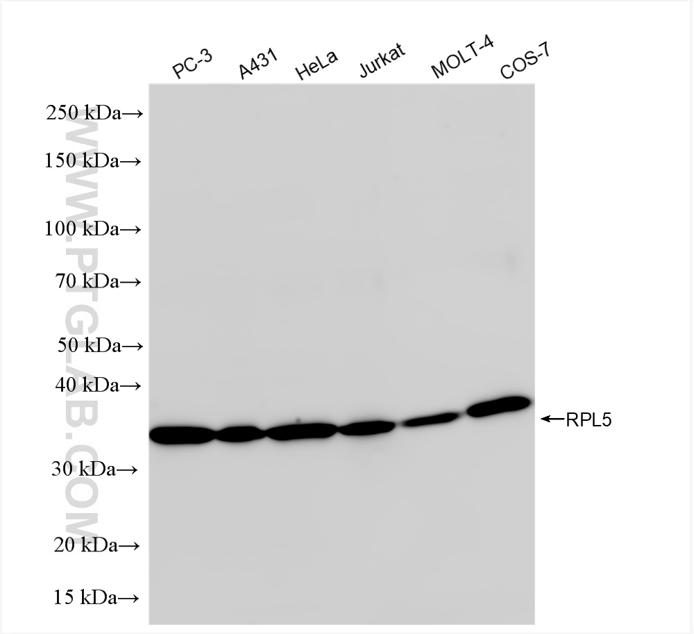 WB analysis using 85348-1-RR (same clone as 85348-1-PBS)