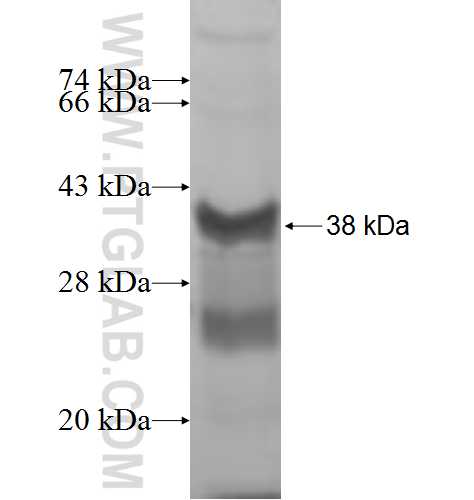 RPL5 fusion protein Ag7673 SDS-PAGE
