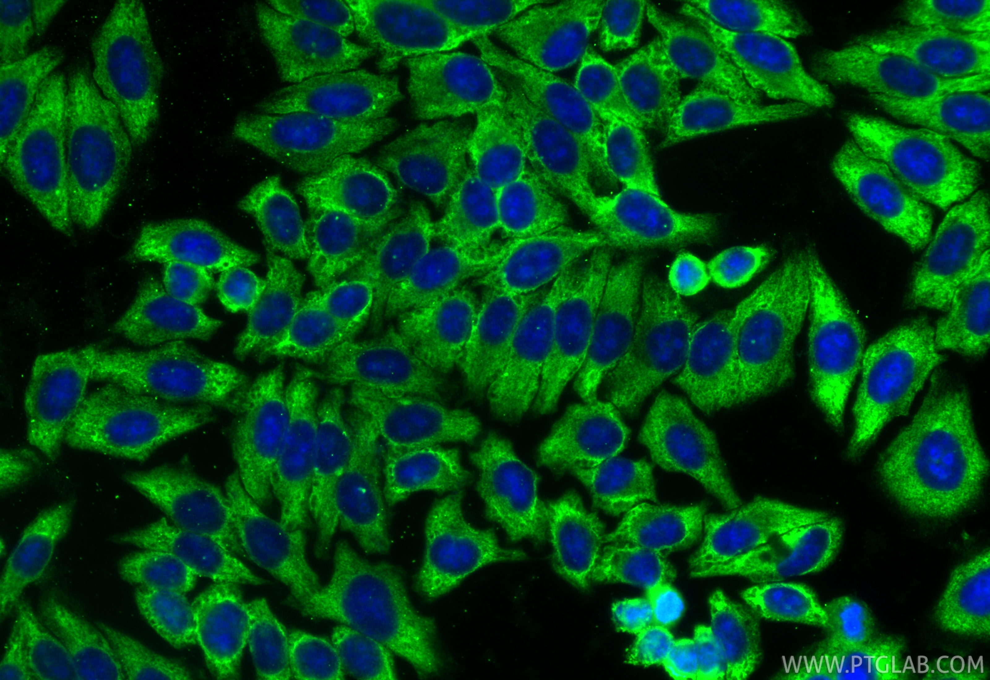 IF Staining of HepG2 using 15387-1-AP IF Staining of HepG2 using 15387-1-AP