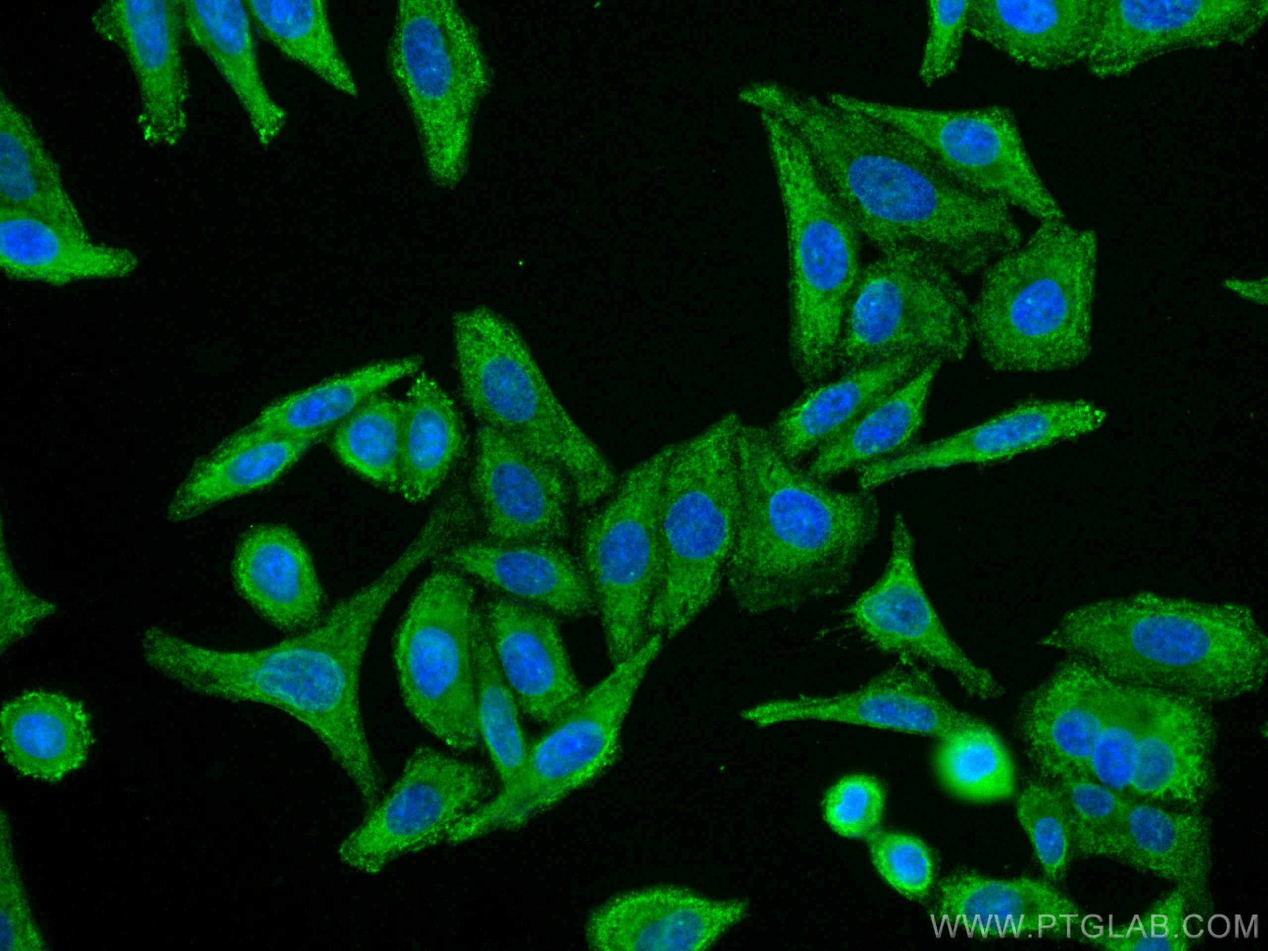 IF Staining of HepG2 using CL488-67729