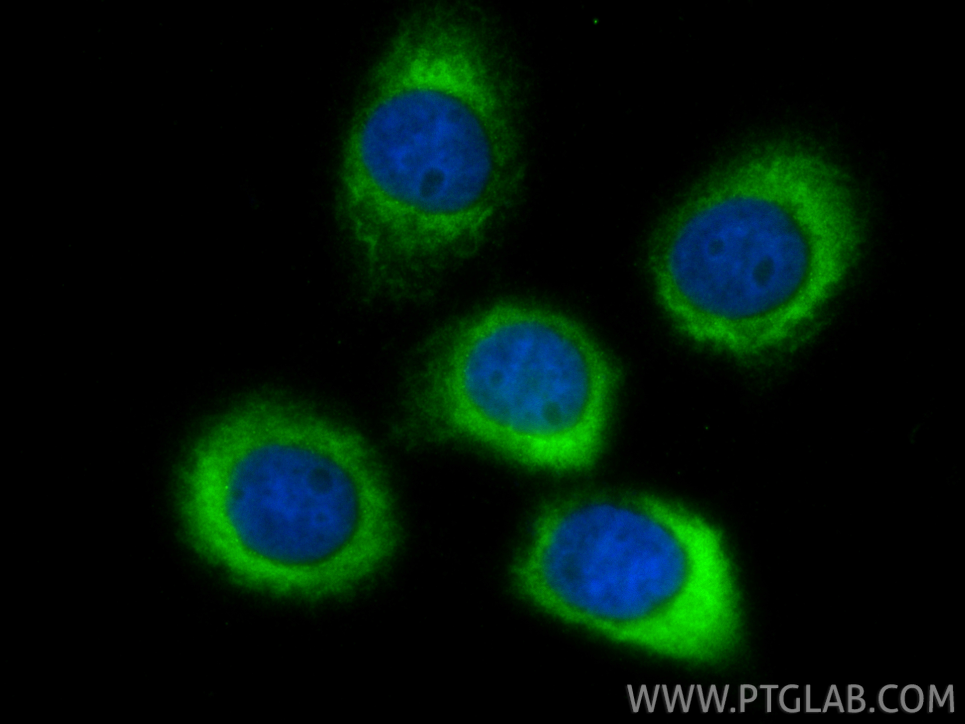 IF Staining of A431 using 14583-1-AP IF Staining of A431 using 14583-1-AP