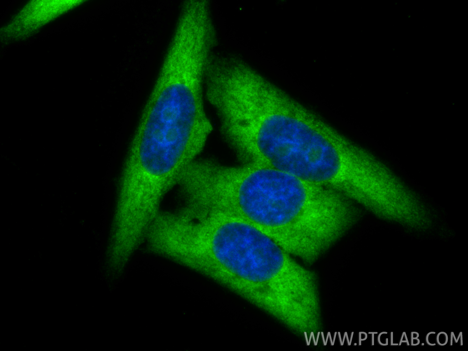 IF Staining of HepG2 using 14583-1-AP IF Staining of HepG2 using 14583-1-AP