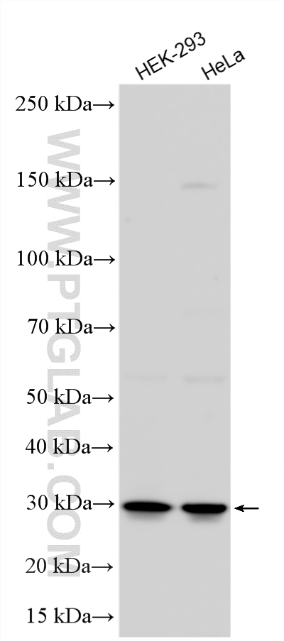 WB analysis using 14583-1-AP WB analysis using 14583-1-AP