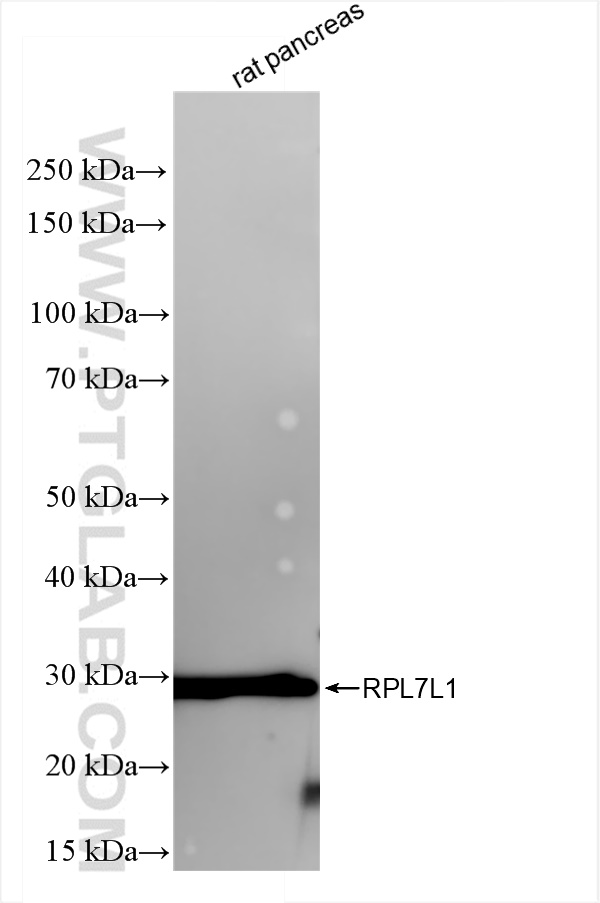 WB analysis of rat pancreas using 84907-1-RR (same clone as 84907-1-PBS)