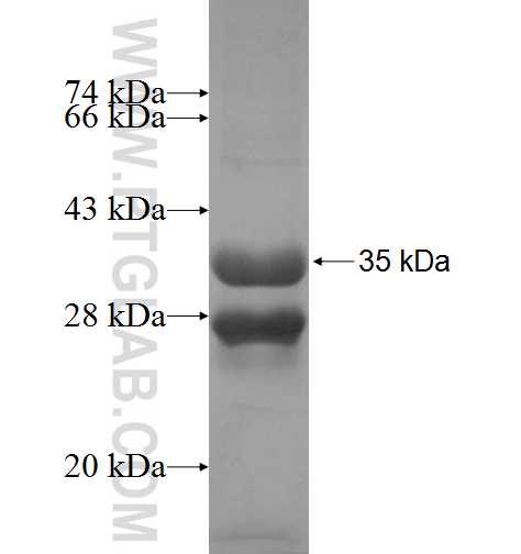 RPL7L1 fusion protein Ag9806 SDS-PAGE