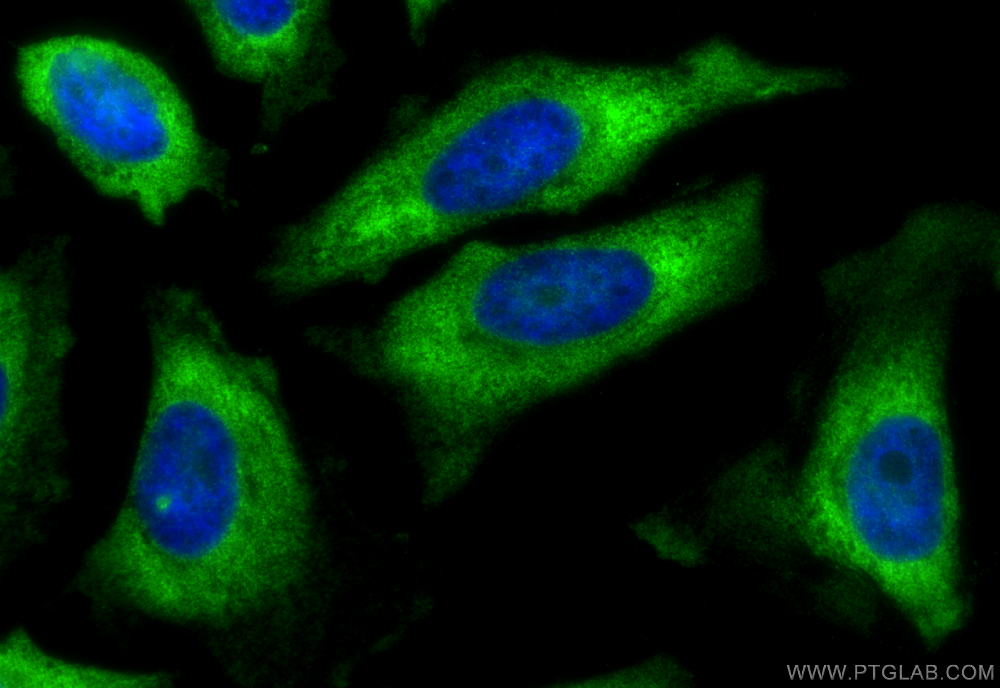 IF Staining of HeLa using 11290-2-AP