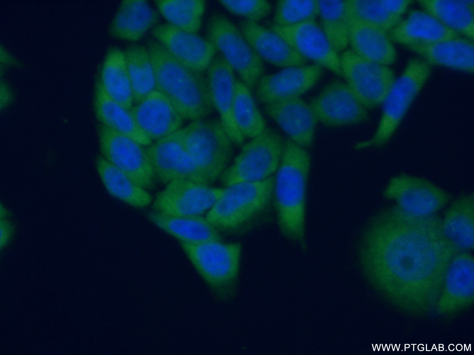 IF Staining of HeLa using 11290-2-AP