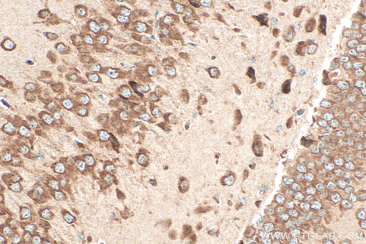 IHC staining of mouse brain using 11290-2-AP