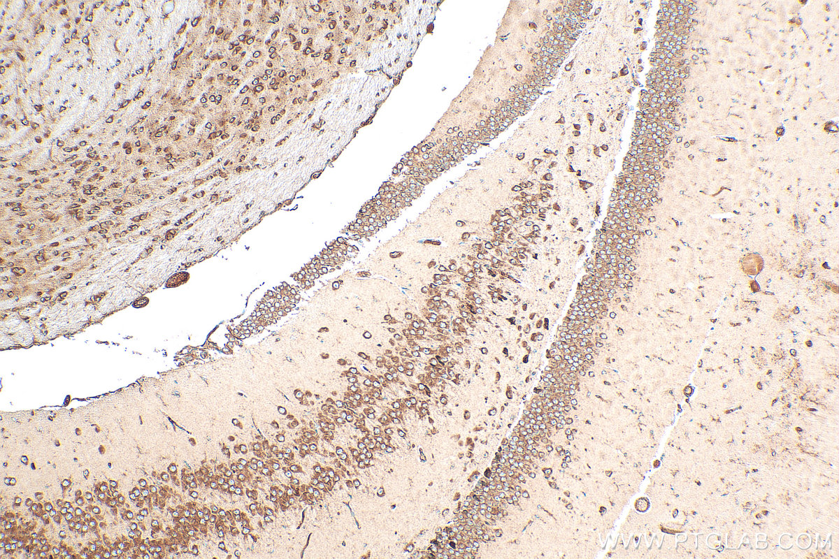 IHC staining of mouse brain using 11290-2-AP