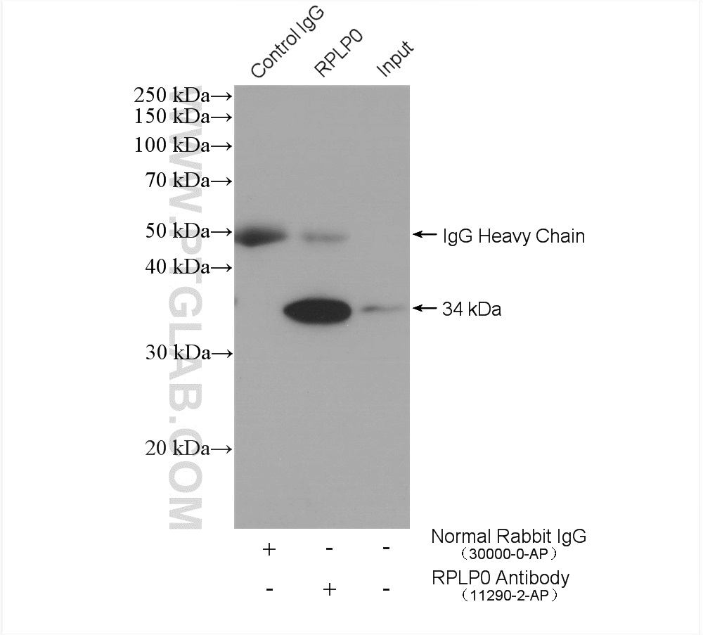 IP experiment of HeLa using 11290-2-AP