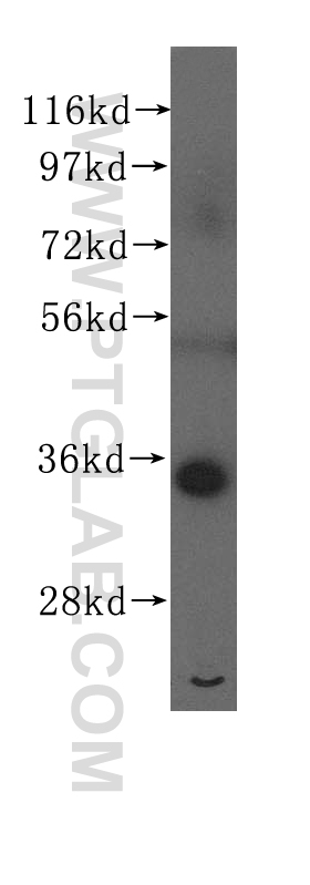 RPLP0 Polyclonal antibody