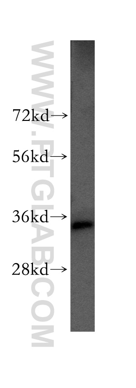 WB analysis of HEK-293 using 51019-2-AP