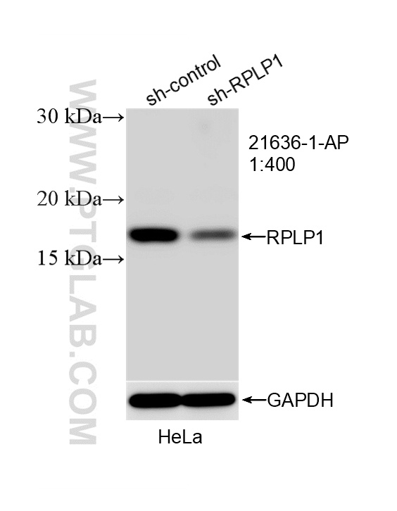WB result of RPLP1 antibody (21636-1-AP; 1:400; incubated at room temperature for 1.5 hours) with sh-Control and sh-RPLP1 transfected HeLa cells. WB analysis of HeLa using 21636-1-AP