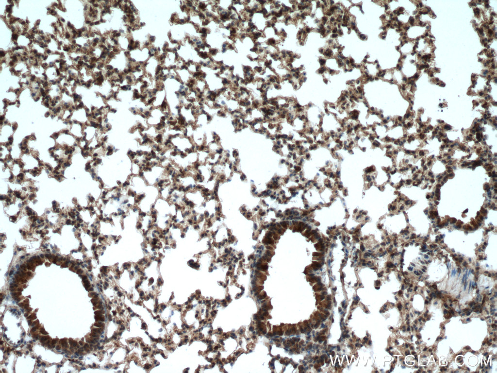 IHC staining of mouse lung using 12894-1-AP