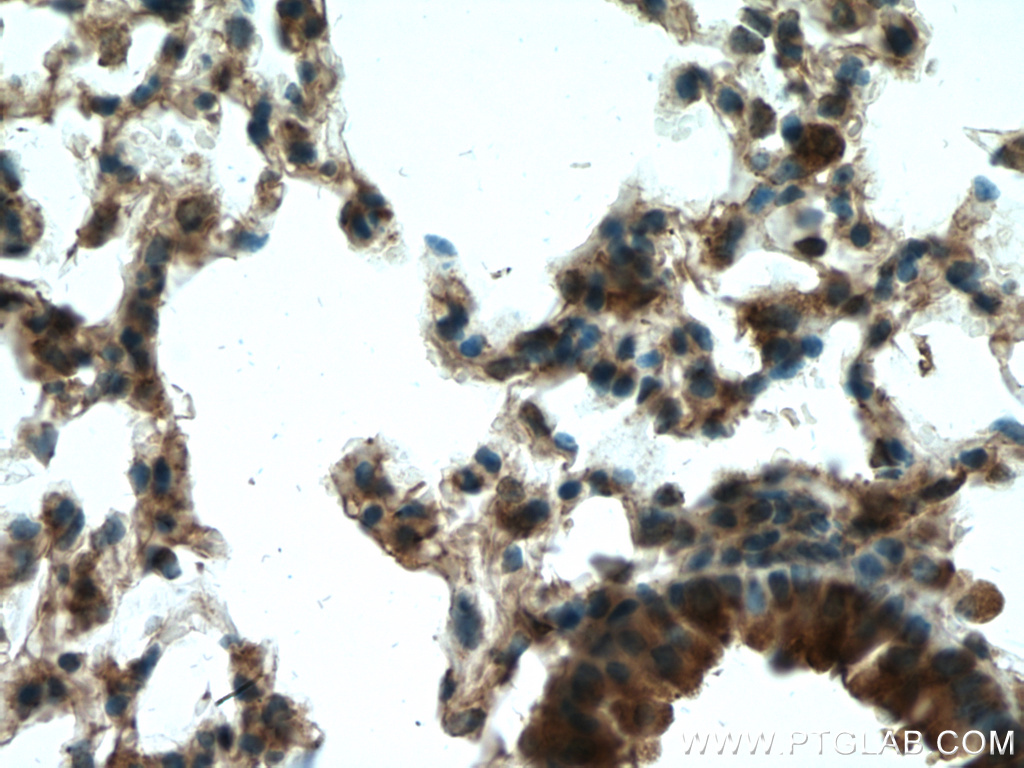 IHC staining of mouse lung using 12894-1-AP