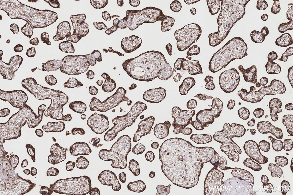 IHC staining of human placenta using 83250-2-RR