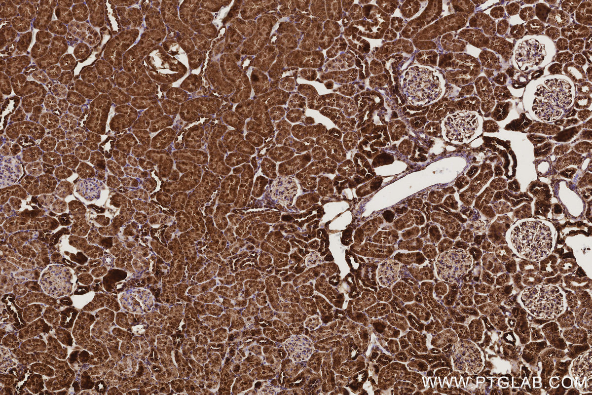 IHC staining of rat kidney using 83250-2-RR