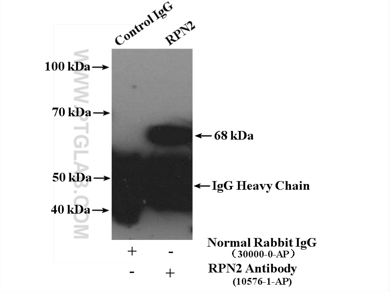 IP experiment of NIH/3T3 using 10576-1-AP