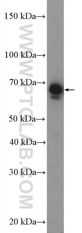 RPN2 Polyclonal antibody