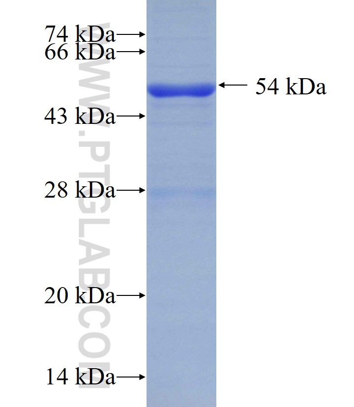 RPN2 fusion protein Ag0862 SDS-PAGE