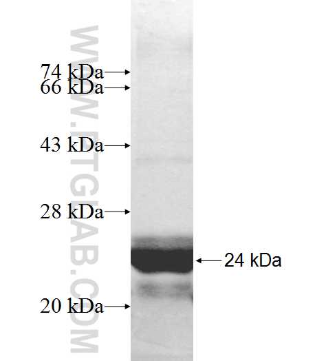 RPP21 fusion protein Ag9627 SDS-PAGE
