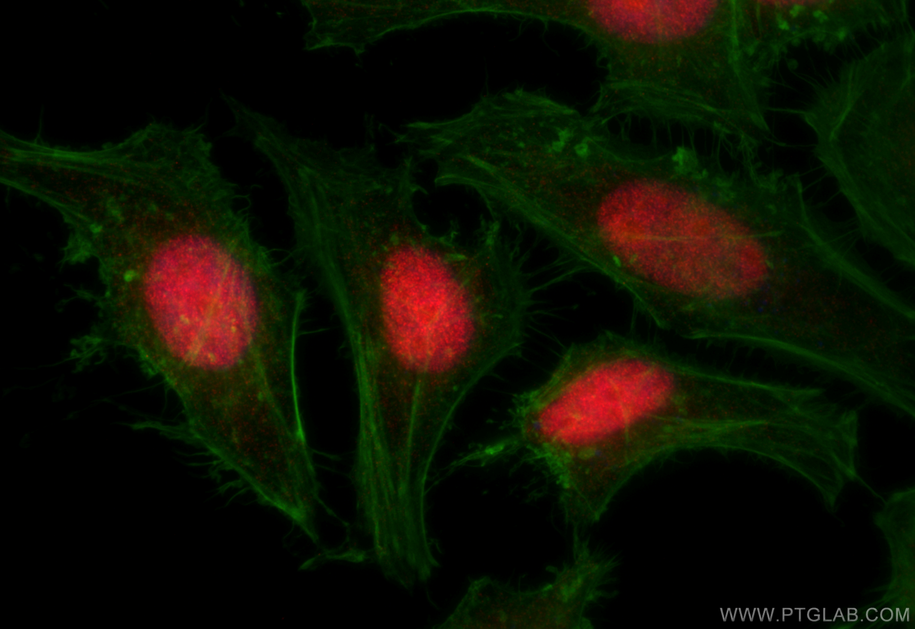 IF Staining of HeLa using 15461-1-AP