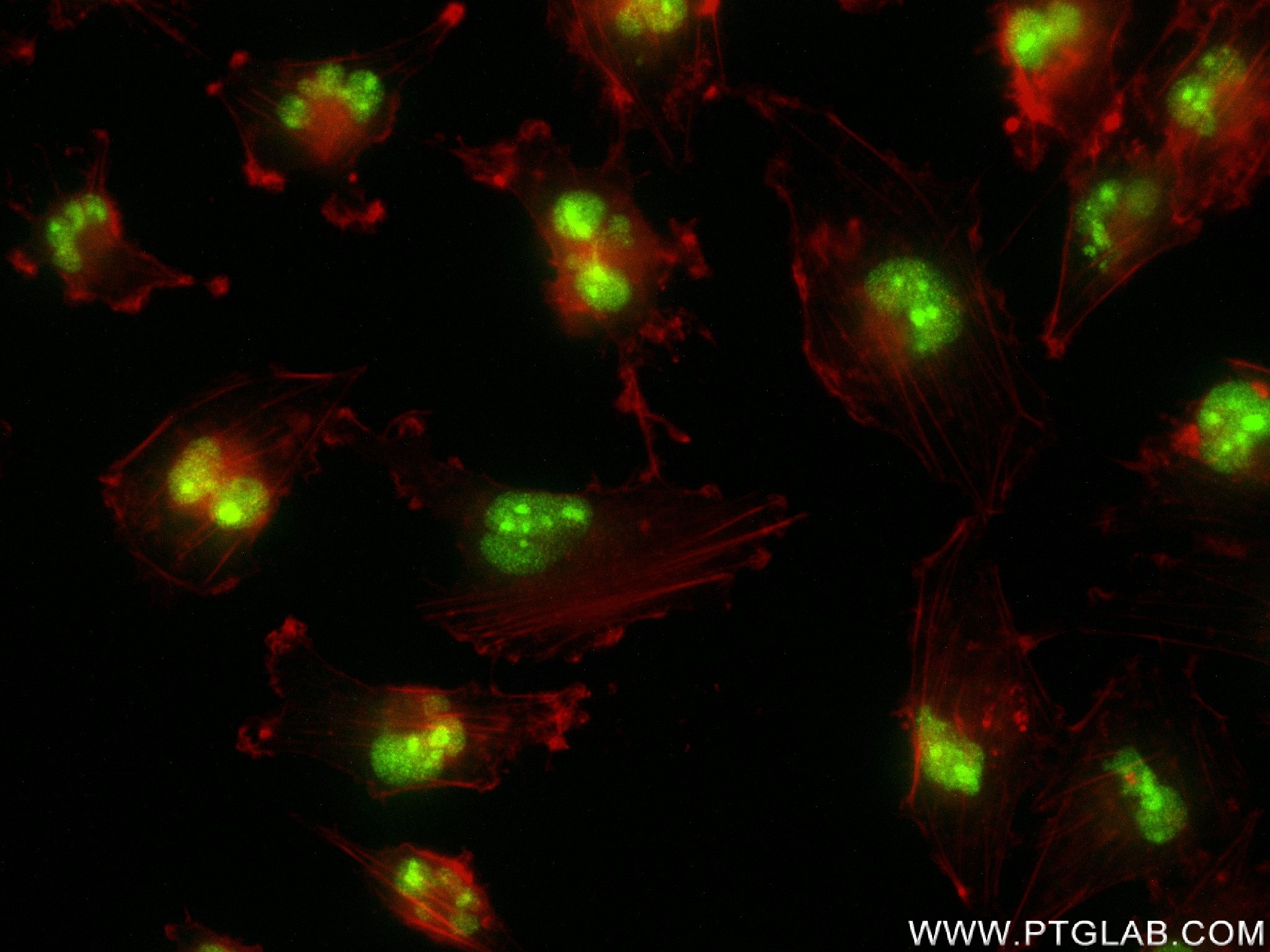 IF Staining of U-251 using 83481-5-RR