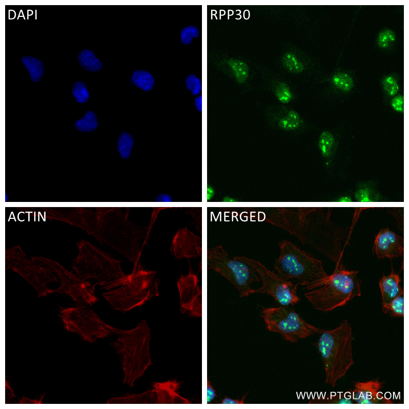 IF Staining of U-251 using 83481-5-RR