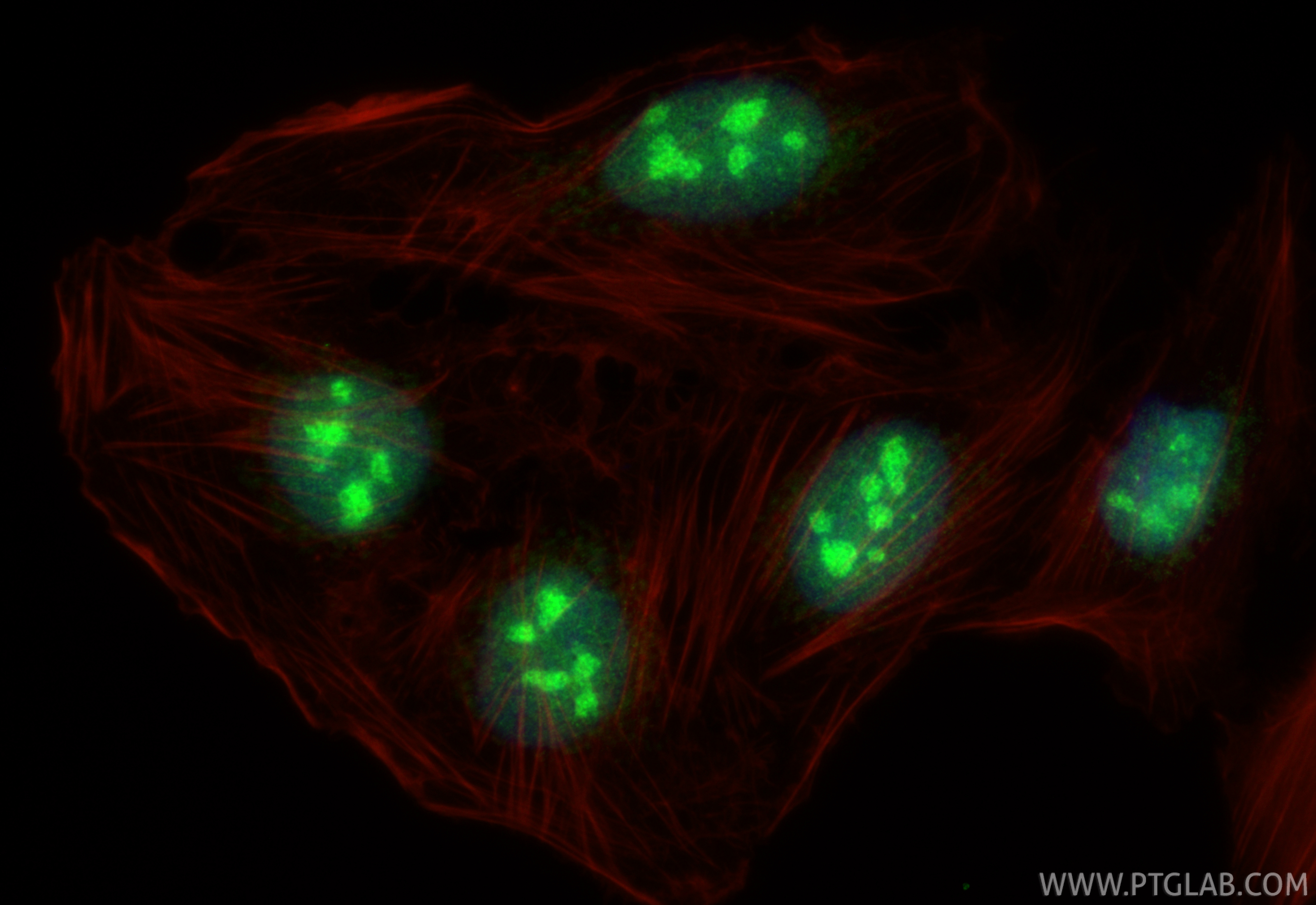 IF Staining of U2OS using 12874-1-AP IF Staining of U2OS using 12874-1-AP
