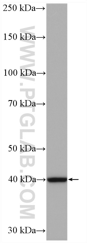 WB analysis of HeLa using 11736-1-AP