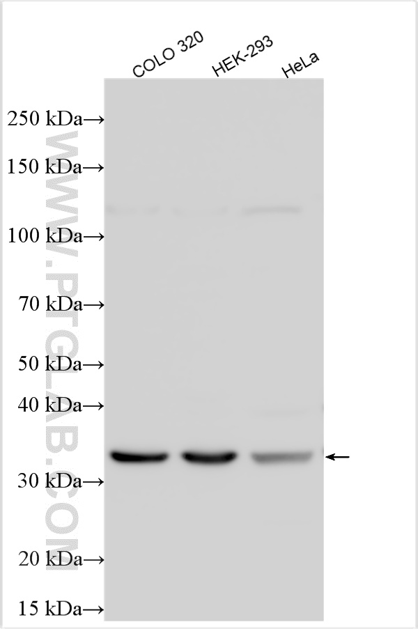 WB analysis using 24542-1-AP WB analysis using 24542-1-AP