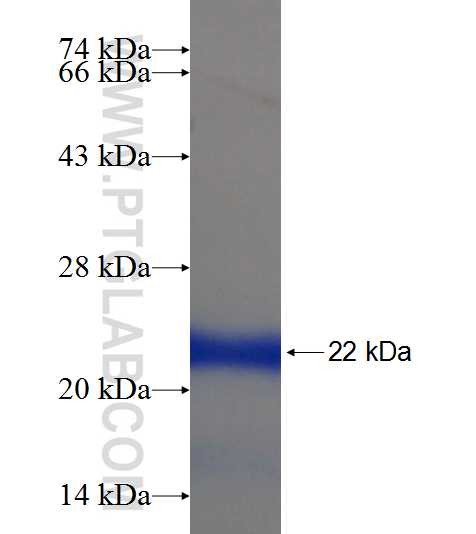 RPRD1B fusion protein Ag21578 SDS-PAGE