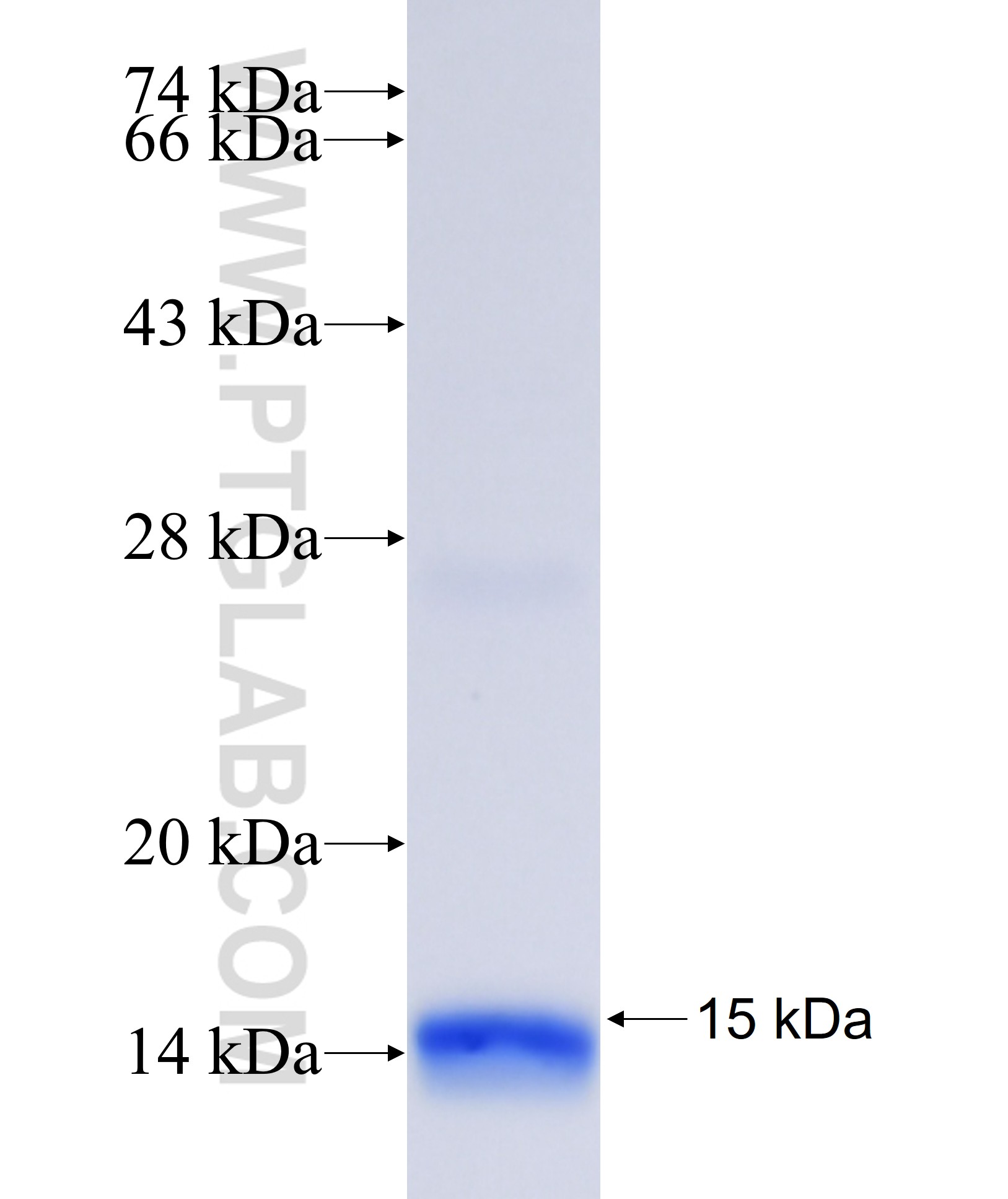 RPS11 fusion protein Ag34909 SDS-PAGE