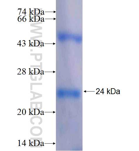 RPS11 fusion protein Ag8361 SDS-PAGE RPS11 fusion protein Ag8361 SDS-PAGE