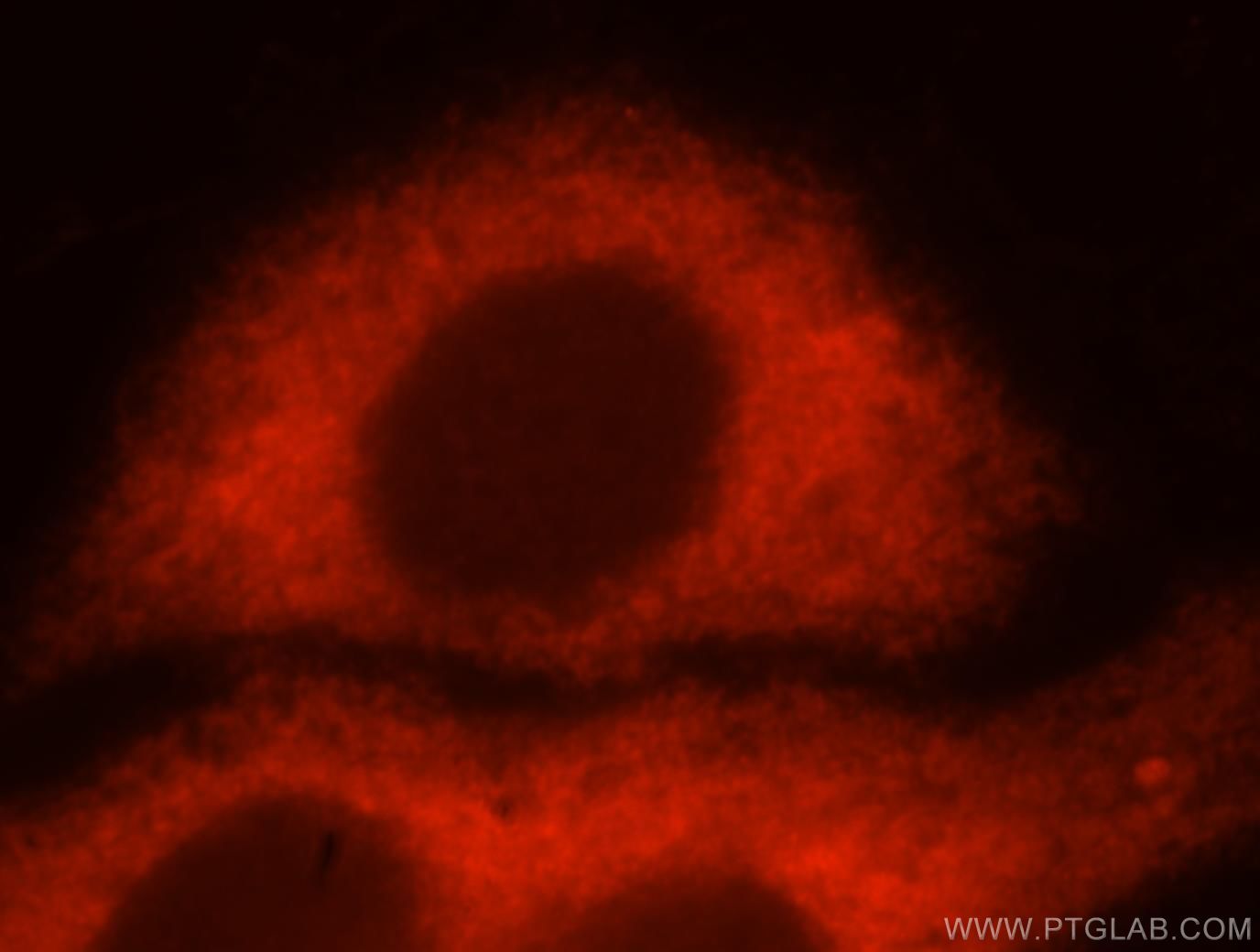 IF Staining of HepG2 using 16490-1-AP