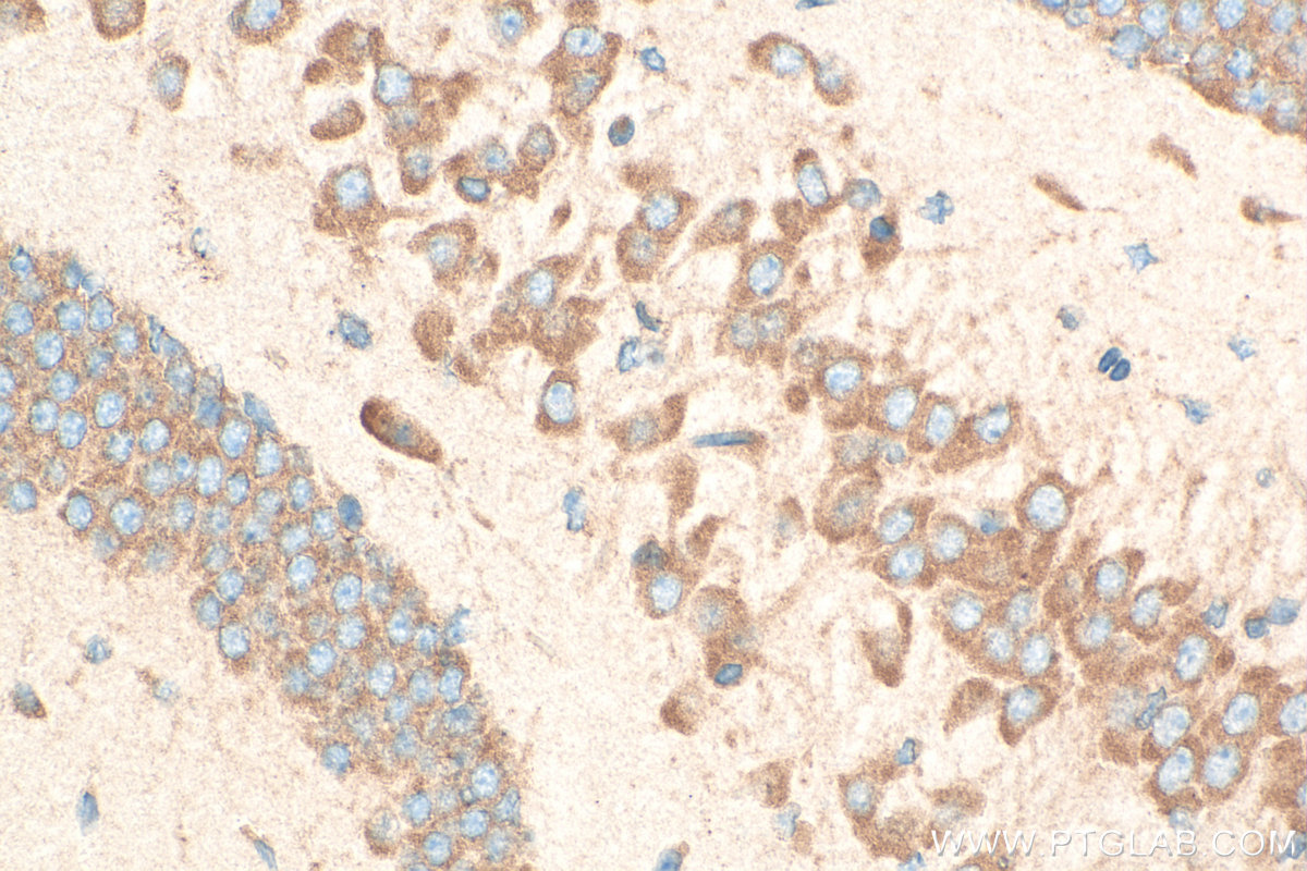 Immunohistochemical analysis of paraffin-embedded mouse brain tissue slide using 16490-1-AP (RPS12 antibody) at dilution of 1:400 (under 40x lens). Heat mediated antigen retrieval with Tris-EDTA buffer (pH 9.0). IHC staining of mouse brain using 16490-1-AP