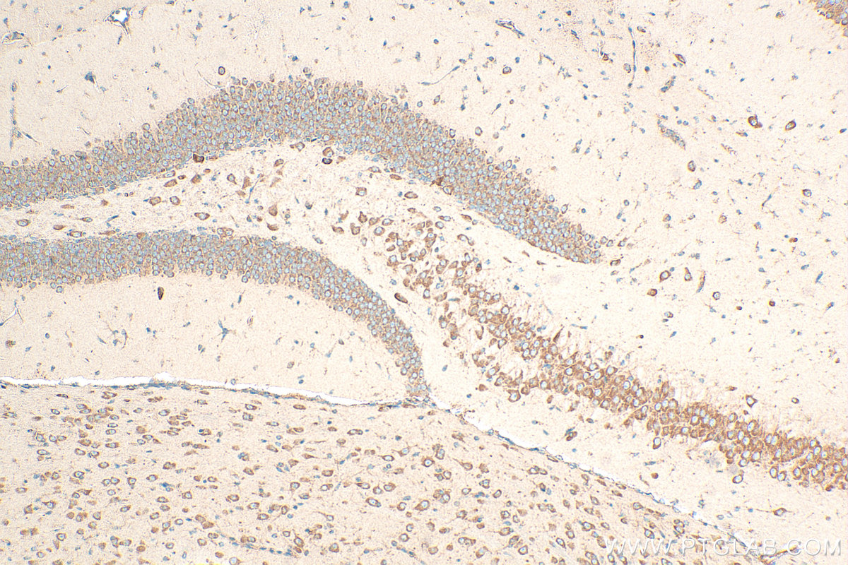Immunohistochemical analysis of paraffin-embedded mouse brain tissue slide using 16490-1-AP (RPS12 antibody) at dilution of 1:400 (under 10x lens). Heat mediated antigen retrieval with Tris-EDTA buffer (pH 9.0). IHC staining of mouse brain using 16490-1-AP