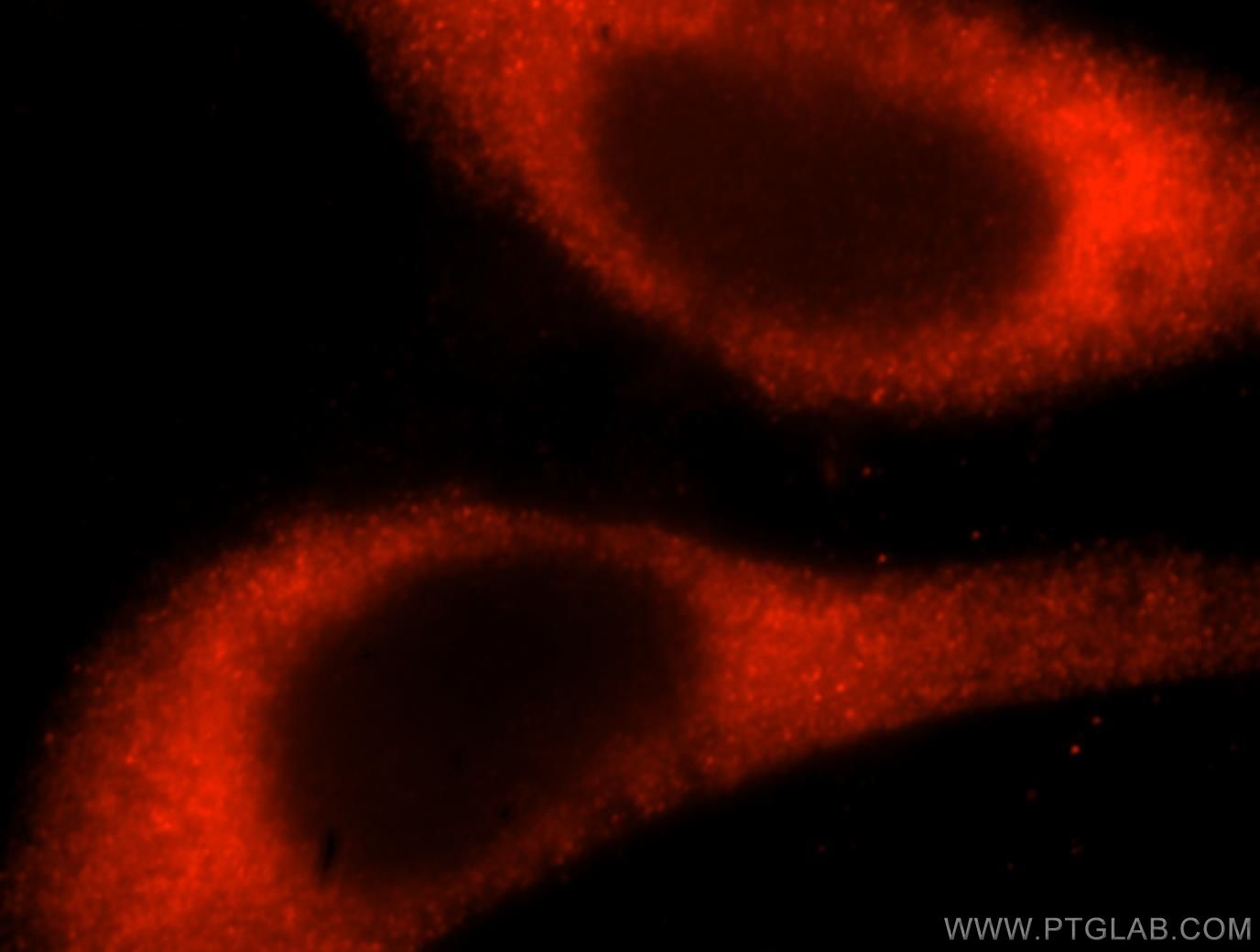 IF Staining of HepG2 using 16683-1-AP