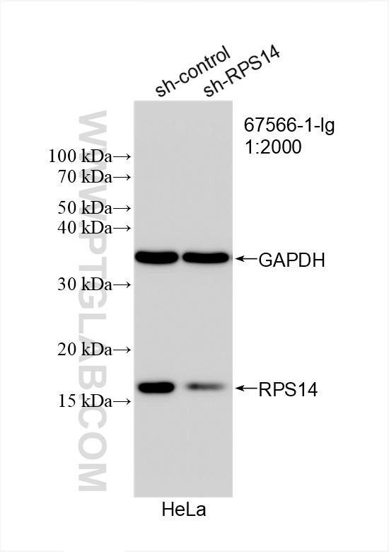 WB analysis of HeLa using 67566-1-Ig